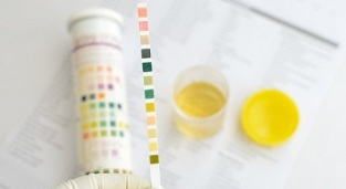 Can I smoke before the urine analysis