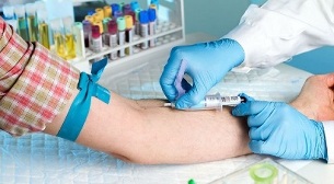 Smoking and undergoing venous blood tests